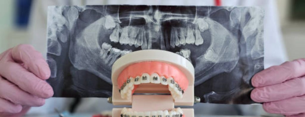 orthodontiste Tanger